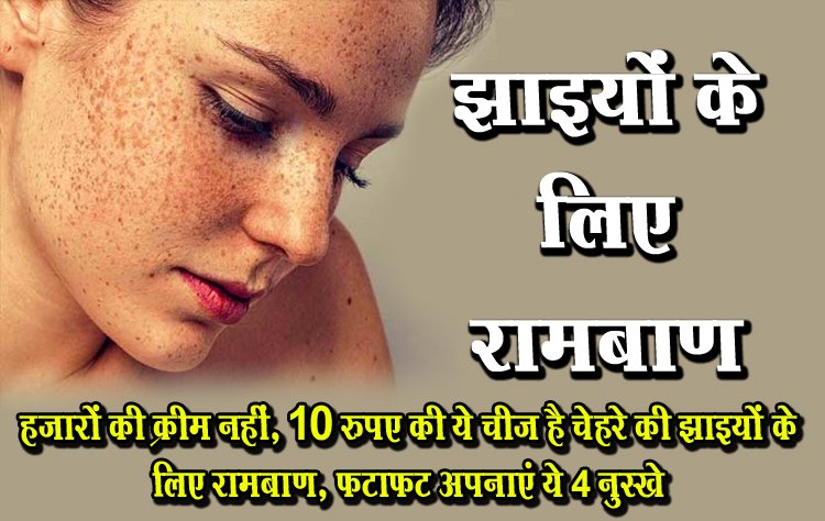 हजारों की क्रीम नहीं, 10 रुपए की ये चीज है चेहरे की झाइयों के ल‍िए रामबाण, फटाफट अपनाएं ये 4 नुस्‍खे