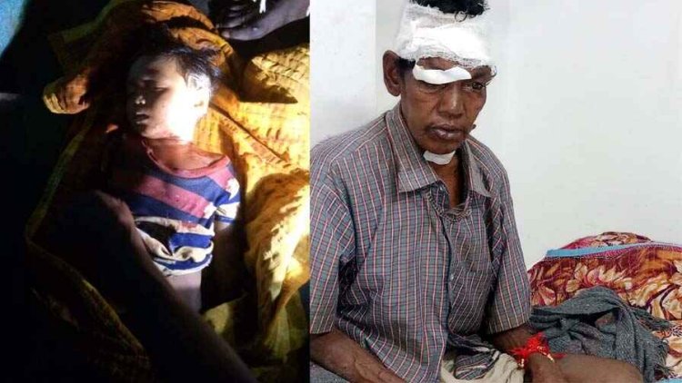 तेंदुए ने 3 साल की बच्ची और बुजुर्ग उसके बाद पालतू कुत्ते का किया शिकार, हाथी ने ग्रामीण को दौड़ाया 1 किलोमीटर, बची जान