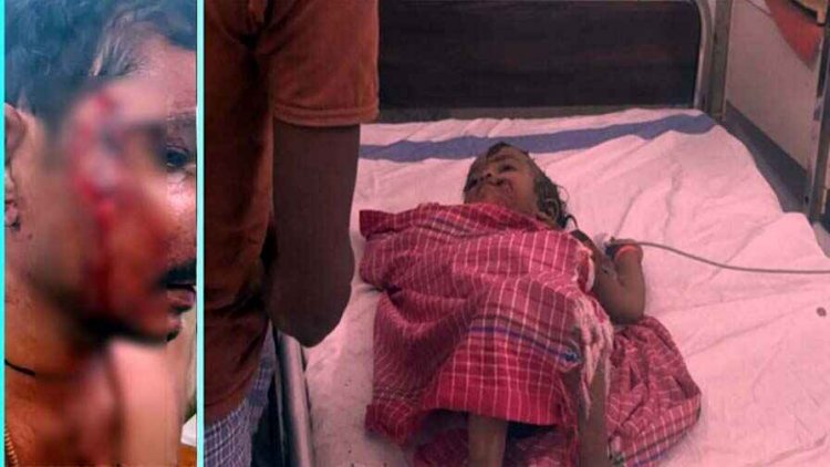 खेत में किसान पर तेंदुए के हमले से छाती और चेहरे में चोट, चार घंटे में दूसरी बार किया हमला, ढाई साल की मासूम बच्ची जख्मी, कमरे में कैद हुआ तेंदुआ