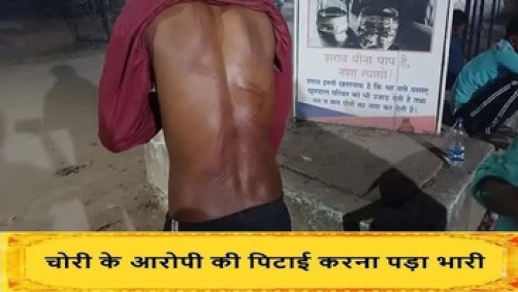 चोरी की नीयत से घुसे दो नाबालिग बच्चों की बेरहमी से पिटाई, अस्पताल में भर्ती, प्लांट के कर्मचारी और गार्ड के खिलाफ मामला दर्ज, जांच में जुटी पुलिस