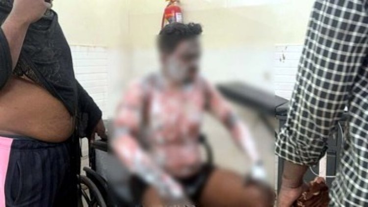 बहन हुई लापता, सदमे में भाई ने खुद को पेट्रोल डालकर किया आग के हवाले, गंभीर रुप से झुलसा, अस्पताल में भर्ती, इलाज के लिए रेफर