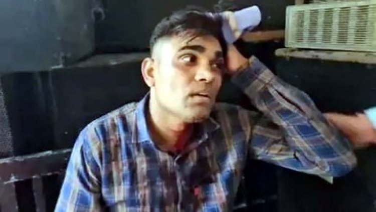 पुलिसकर्मी का सिर फोड़ा, डंडे और रॉड से बदमाशों ने किए कई वार, पुलिस ने 2 बदमाशों को किया गिरफ्तार, दो साथी फरार, तलाश जारी