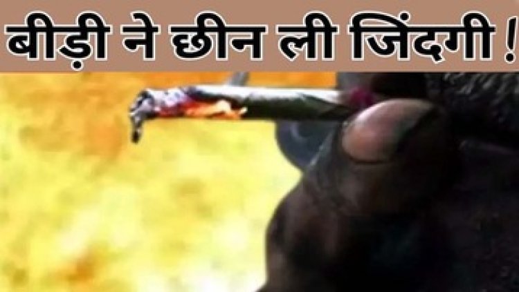 बीड़ी पीते-पीते आई नींद, घर में भीषण आग, बुजुर्ग जिंदा जला, जिंदगी और मौत के बीच चल रही जंग, दमकल विभाग ने मशक्कत के बाद पाया काबू