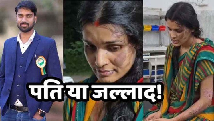 पत्नी को एक हफ्ते तक बनाया बंधक, गर्म लोहे के सलाखों से जलाया, खौलते पानी में चेहरा डुबोया, आकाश तिवारी गिरफ्तार, सास-ससुर फरार