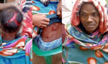 गरियाबंद में भालू का खौफ, 48 वर्षीय धनेश पर हमला, लहूलुहान हालत में अस्पताल में भर्ती, ग्रामीण कर रहे सुरक्षा की मांग