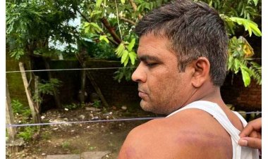 नशे में धुत्त ग्रामीण ने स्कूल में घुसकर शराब के लिए मांगे पैसे, शिक्षक पर लाठी से हमला, थाने में एफआईआर दर्ज, आरोपी अभिभावक फरार