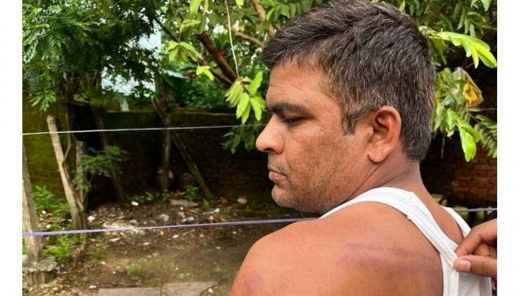 नशे में धुत्त ग्रामीण ने स्कूल में घुसकर शराब के लिए मांगे पैसे, शिक्षक पर लाठी से हमला, थाने में एफआईआर दर्ज, आरोपी अभिभावक फरार