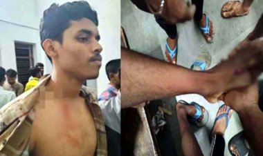 रायपुर के साइंस कॉलेज हॉस्टल में बवाल, बेखौफ बदमाशों ने छात्रों से की मारपीट, मोबाइल छीनकर फरार, छात्रों की सुरक्षा पर उठे सवाल