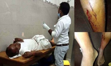 तालाब में नहाने गए चार लोगों पर लोमड़ी ने किया हमला, एक की हालत नाजुक, अस्पताल में भर्ती, ग्रामीणों में दहशत का माहौल