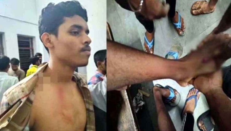 रायपुर के साइंस कॉलेज हॉस्टल में बवाल, बेखौफ बदमाशों ने छात्रों से की मारपीट, मोबाइल छीनकर फरार, छात्रों की सुरक्षा पर उठे सवाल