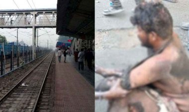 रेलवे की लापरवाही से यार्ड में पेंटिंग के दौरान करंट से झुलसा युवक, इलाज के दौरान हुई मजदूर की मौत, एम्बुलेंस उपलब्ध न होने पर उठे सवाल