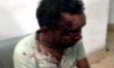 गाली-गलौज का विरोध पड़ा भारी, नशे में धुत युवकों ने घर में घुसकर मचाया आतंक, युवक को सड़क पर घसीटकर की लात-घूंसों से पिटाई