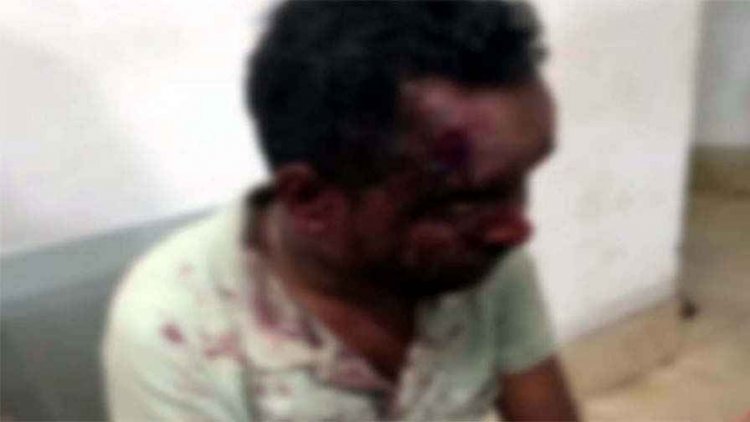 गाली-गलौज का विरोध पड़ा भारी, नशे में धुत युवकों ने घर में घुसकर मचाया आतंक, युवक को सड़क पर घसीटकर की लात-घूंसों से पिटाई