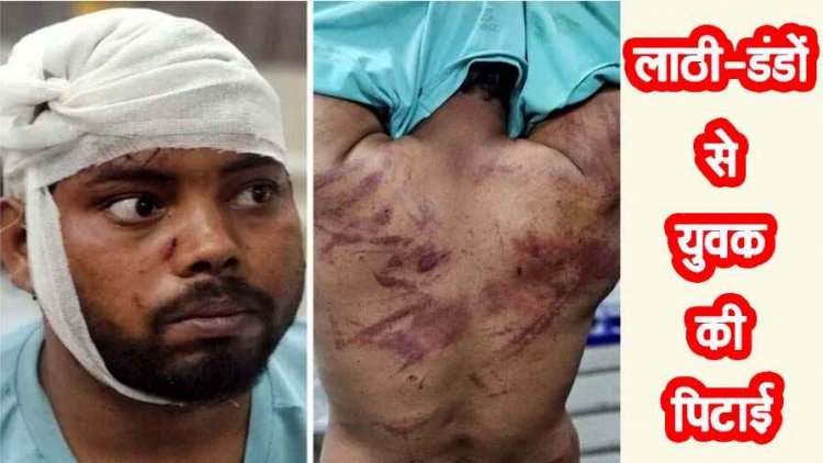 नववर्ष पिकनिक बना खौफनाक, एनीकट के पास चार युवकों ने किया हमला, बेल्ट-रॉड से की जमकर पिटाई, आरोपी फरार, तलाश में जुटी पुलिस