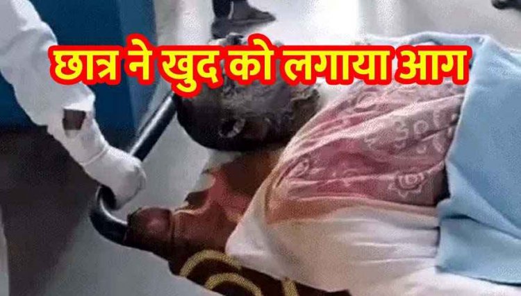 हॉस्टल में रहने वाले स्टूडेंट ने खुद को लगाई आग, हालत नाजुक, कारण अज्ञात, रुम से बाहर निकलकर उड़ेला पेट्रोल, पिता BSF में पदस्थ