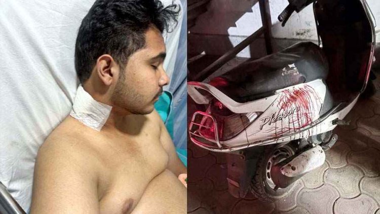 भेल खाने पहुंचे कांग्रेस नेता के बेटे पर चाकू से जानलेवा हमला, तीन युवक घायल, एक की हालत नाजुक, फैली सनसनी, सभी आरोपी फरार 