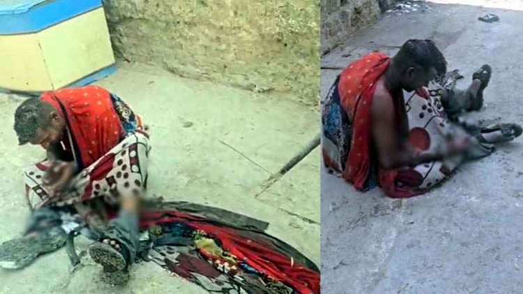 युवक ने खुद को आग लगाकर की खुदकुशी की कोशिश, इलाज जारी, पत्नी की नाराजगी और नशा बनी वजह?, पुलिस की तत्परता से बची जान