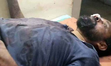 रायपुर में CM हाउस के पास युवक पर चाकू से जानलेवा हमला, 15 हजार की लूट, पांच बदमाशों ने घेरकर किया वार, आरोपियों की तलाश में जुटी पुलिस