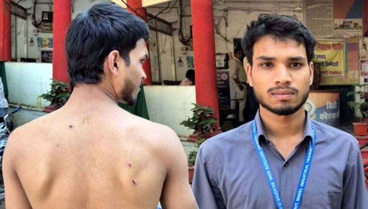 बाइक टकराने की मामूली घटना पर आईटीआई छात्र पर बदमाशों ने किया जानलेवा हमला, चेहरे और पीठ पर आई गंभीर चोटें, जांच में जुटी पुलिस