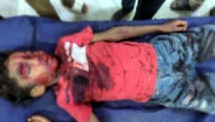 नशे में ट्रैक्टर चालक बना मासूम की जान का दुश्मन, जोरदार टक्कर में 5 साल का बालक गंभीर, आक्रोशित ग्रामीणों ने ड्राइवर की कर दी पिटाई