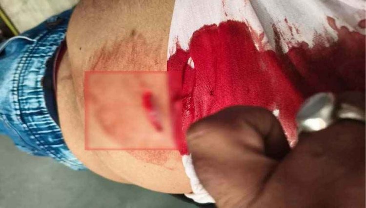 मंदिर परिसर में चाकूबाजी, शराब पीने से रोका तो युवक पर हमला, अस्पताल में भर्ती, इलाज जारी, इलाके में फैली सनसनी, चार आरोपी फरार, तलाश जारी