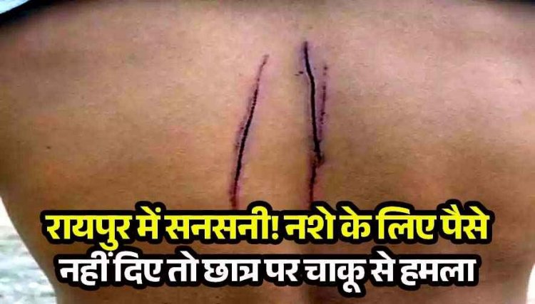 रायपुर में 12वीं छात्र से बदमाशों ने 2 हजार रुपए की मांग, नशे के लिए पैसे न देने पर जानलेवा हमला, इलाज जारी, करण पांडेय और उदय के खिलाफ केस दर्ज