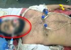 बारिश में अनियंत्रित होकर पेड़ से टकराई GT 650 बाइक, CMD कॉलेज के छात्र की इलाज के दौरान मौत, इलाके में पसरा मातम, जांच में जुटी पुलिस