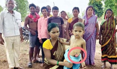 युवराज को इलाज की दरकार, राष्ट्रपति के दत्तक पुत्र कमार जनजाति के गरीब माता पिता की गुहार- मेरे बच्चे को बचाव सरकार, मुख्यमंत्री से लगाई गुहार