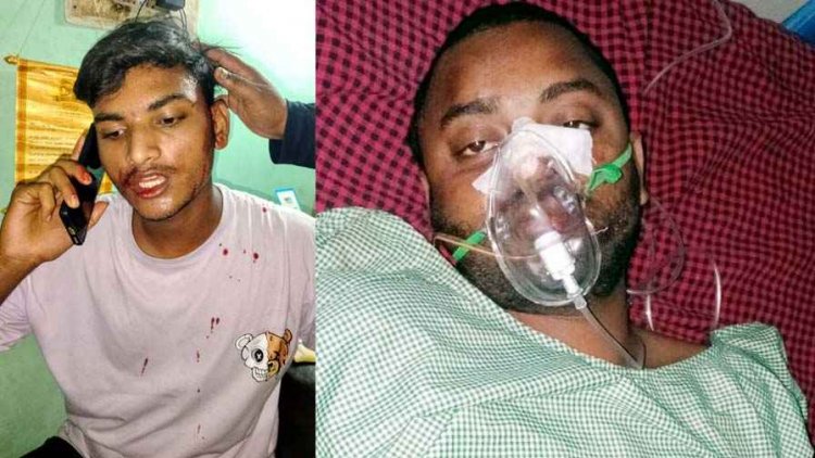 बाइक हटाने महिला से विवाद, शांत कराने पहुंचे युवकों पर चाकू से जानलेवा हमला, 2 युवक गंभीर, अस्पताल में भर्ती, इलाके में तनाव का माहौल, आरोपी फरार