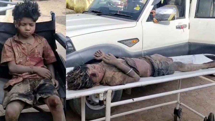 ईंट भट्ठे पर ट्रैक्टर पलटने से बड़ा हादसा, तीन नाबालिग मजदूर गंभीर घायल, अस्पताल में भर्ती, इलाज जारी, प्रशासनिक व्यवस्था और निगरानी पर उठ रहे सवाल