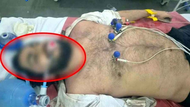 बारिश में अनियंत्रित होकर पेड़ से टकराई GT 650 बाइक, CMD कॉलेज के छात्र की इलाज के दौरान मौत, इलाके में पसरा मातम, जांच में जुटी पुलिस