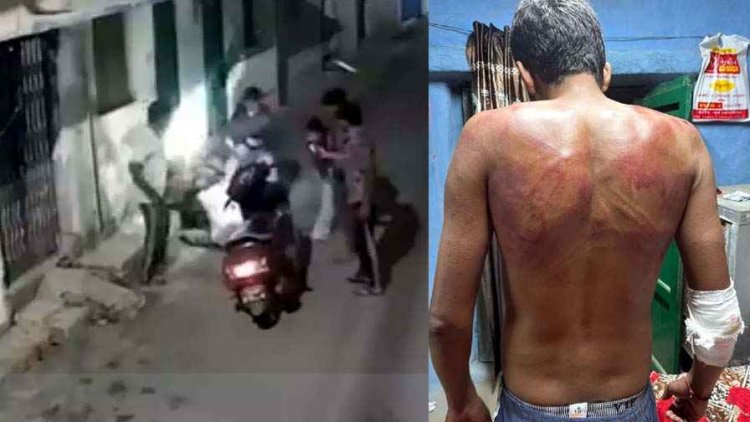 स्कूटी में दवा लेने जा रही बहन से छेड़छाड़, विरोध कर रहे भाई की बेरहमी से पिटाई, वीडियो आया सामने, 5 लोगों के खिलाफ मामला दर्ज, जांच में जुटी पुलिस