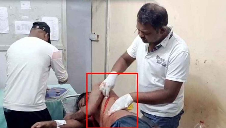 कॉलोनी के सामने कटरबाजी, 5 लोगों ने पैसों के विवाद को लेकर युवक को घेरकर चलाया कटर, इलाज जारी, बदमाशों की तलाश में जुटी पुलिस