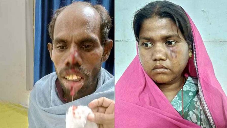 कुत्ते ने ग्रामीणों पर किया हमला, हमले से दो ग्रामीण घायल, हालत नाजुक, गरियाबंद जिला अस्पताल रेफर, गांव में अफरा-तफरी का माहौल