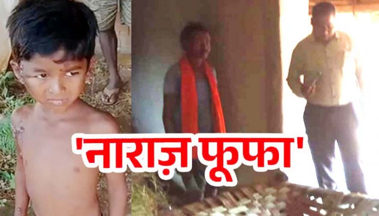 नाराज फूफा ने आधी रात सो रहे ससुर-भतीजे पर पेट्रोल डालकर लगाई आग, 6 वर्षीय मासूम समेत दोनों झुलसे, इलाज जारी, आरोपी दामाद भजन गिरफ्तार