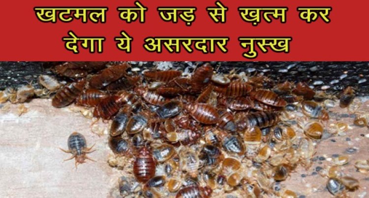 Bedbugs: खटमल को जड़ से ख़त्म कर देगा ये असरदार नुस्खे 