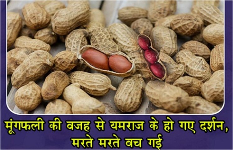 Health News : मूंगफली की वजह से यमराज के हो गए दर्शन, मरते-मरते बच गई