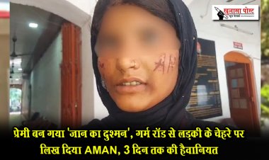 प्रेमी बन गया 'जान' का दुश्मन, गर्म रॉड से लड़की के चेहरे पर लिख दिया AMAN, 3 दिन तक की हैवानियत