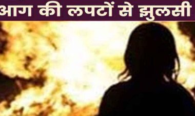 आग में झुलसी नाबालिग लड़की, खाना बनाते वक्त हुआ हादसा, आनन फानन में जिला अस्पताल में इलाज के लिए कराया गया भर्ती