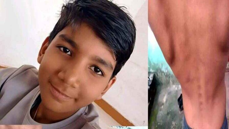 छत्तीसगढ़ के स्कूल में रैगिंग, 6वीं क्लास के छात्र को सीनियर छात्रों ने पीटा, पीठ और हाथ पर चोट के निशान, थाने में शिकायत दर्ज