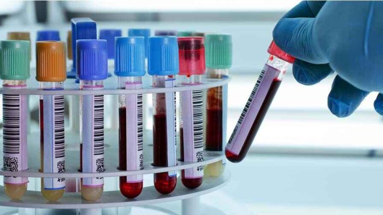 सुर्या पैथोलॉजी लैब में दी खून जांच की गलत रिपोर्ट, डॉक्टर ने इलाज करने से किया  इंकार, मरीज को किया रेफर, जांच के नाम पर स्वास्थ्य से खिलवाड़!