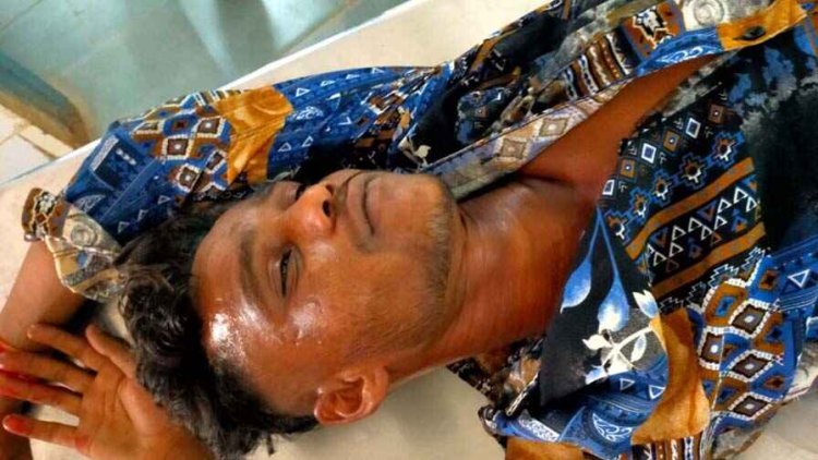 24 कैरेट होटल के पास अज्ञात युवक ने मारा चाकू, अतड़ी बाहर, हालत नाजुक, घायल सिम्स रेफर, आरोपियों की तलाश में जुटी पुलिस