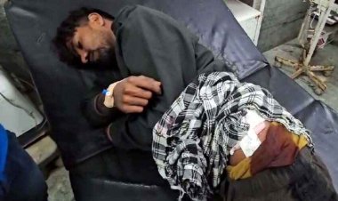 दहशत के साए में जीने को मजबूर जनता, चाकूबाजी के बाद दिनदहाड़े 50 हजार की लूट, टाइल्स मिस्त्री गंभीर रुप से घायल, आरोपी फरार