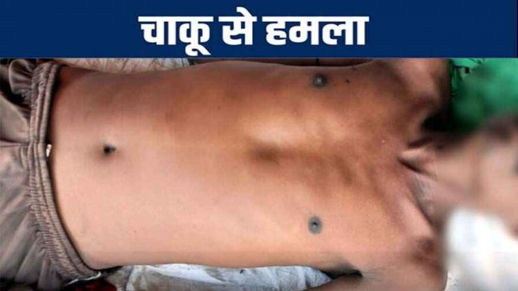 बाइक मांगना पड़ा भारी, आरोपी ने पिता-पुत्र पर चाकू से किया ताबड़तोड़ हमला, झोपड़ी में मिली युवक की लाश, हत्या या हादसा?, जांच में जुटी पुलिस