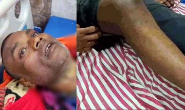 सूरजपुर में जमीन विवाद को लेकर पत्नी और बहन-बहनोई ने पति को 10 दिनों तक बनाया बंधक, हथौड़ी मारकर तोड़ा हाथ-पैर, पिला दिया एसिड