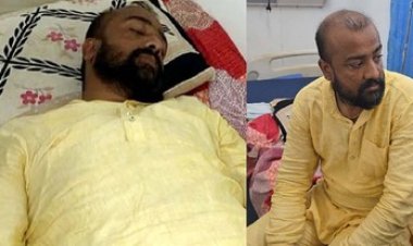 नगर निगम चुनाव: महापौर प्रत्याशी पर जानलेवा हमला, घर जाते वक्त बदमाशों ने बनाया शिकार, अस्पताल में इलाज जारी, जांच में जुटी पुलिस