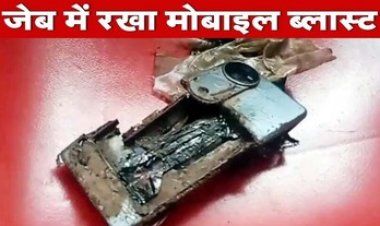 पैंट की जेब में मोबाइल लेकर घूम रहा था युवक, अचानक हुआ जोरदार ब्लास्ट, पैर झुलसा, इलाज के लिए अस्पताल में भर्ती