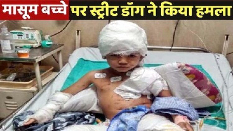 राजधानी में डॉग बाइट की दर्दनाक घटना, 10 मिनट तक छह साल के मासूम को नोचते रहे तीन आवारा कुत्ते, खोपड़ी खुल गई, शरीर में 200 से ज्‍यादा छेद