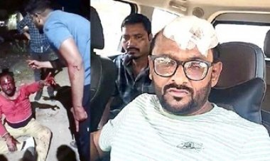 थार से टक्कर के बाद कार सवार डॉक्टर ने भाई के साथ मिलकर युवक को बेरहमी से किया पिटाई, खंभे से टकराकर फोड़ दिया सिर