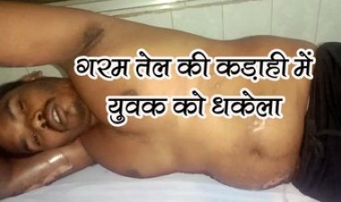 विवाह समारोह के दौरान मामूली विवाद बनी जानलेवा, गरम तेल की कड़ाही में युवक को धकेला, दो के खिलाफ मामला दर्ज